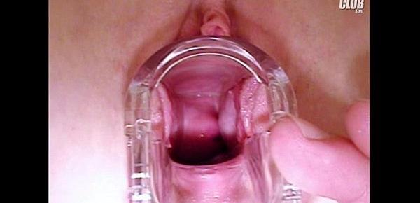  Nia gyno pussy speculum exam at clinic